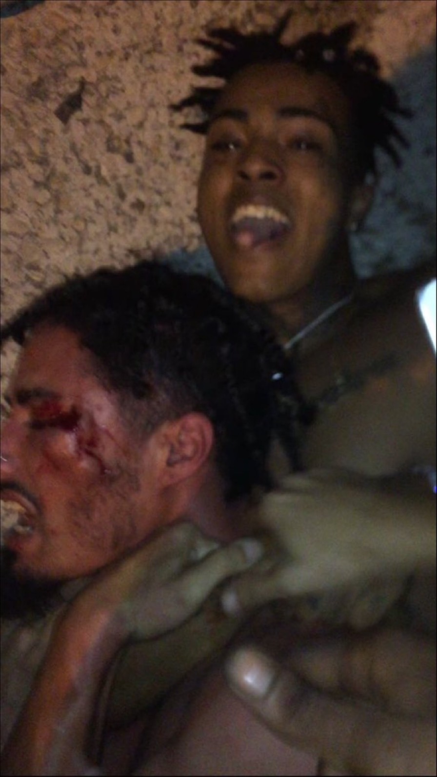 XXXTENTACION in a Street Fight, 2015